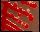 Serratia marcescens